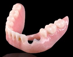 Cu-Sil denture Affordable dental treatment